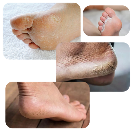 Foot Reset — Pés Renovados em 7 Dias. Sem Salão.